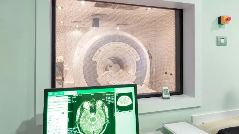 MRI gép a távolban, közelben egy képernyő, amin az agy képe látható.