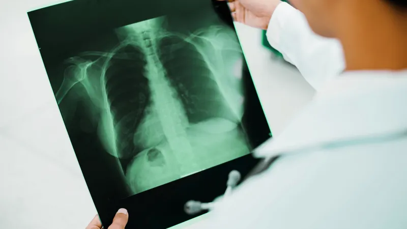 A man in medical scrubs holding a picture of a chest x-ray.